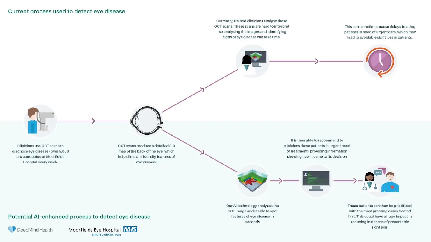An infographic of the current process used to detect eye disease. It starts with an OCT scan which is analysed by a trained technician, this takes time so can cause delays in treating patients in need of urgent care. Instead, AI can analyse the OCT image and identify features of eye disease in seconds, passing that recommendation on to the clinician.